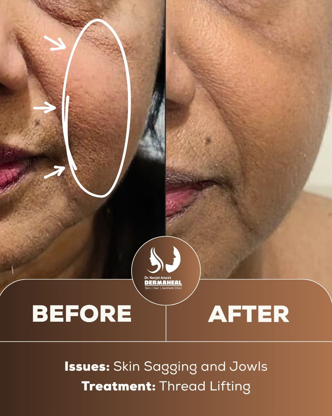 Before/After